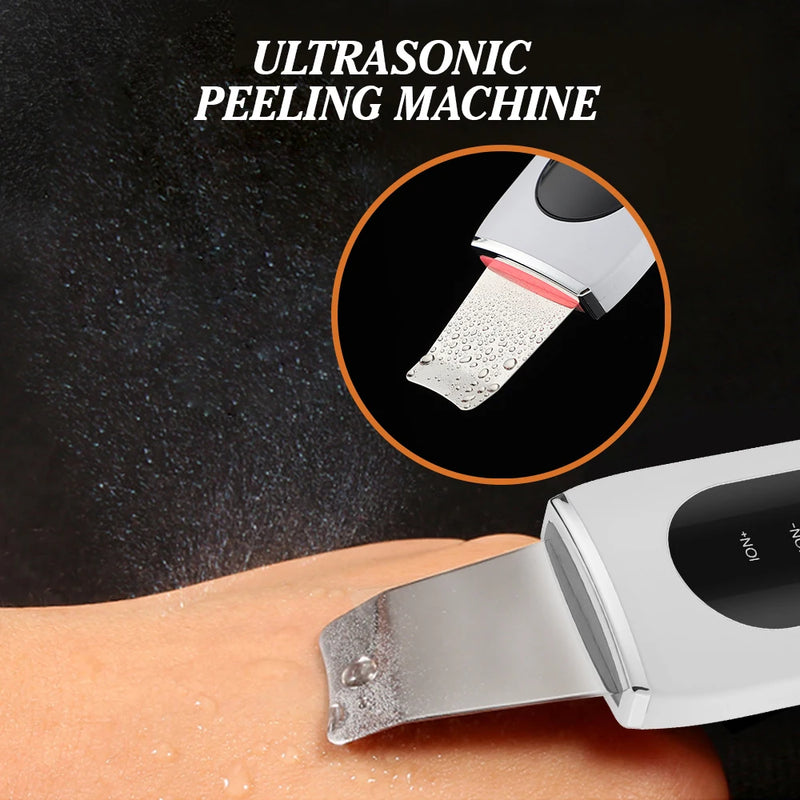 Ultrasonic Skin Scrubber, removedor de cravos, limpeza facial profunda, íon ultra-sônico, poro limpador, Facial Shovel Cleanser